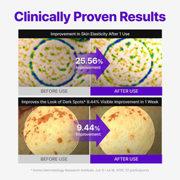 Before and after effects of a skincare product on skin elasticity and dark spots with clinical data.