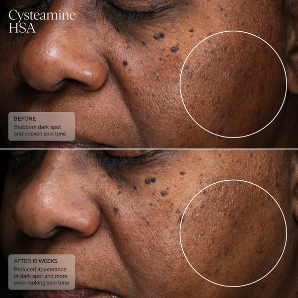 Senté Limited Edition Even Skin Tone Kit