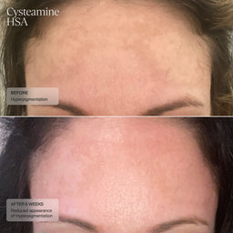 Senté Limited Edition Even Skin Tone Kit