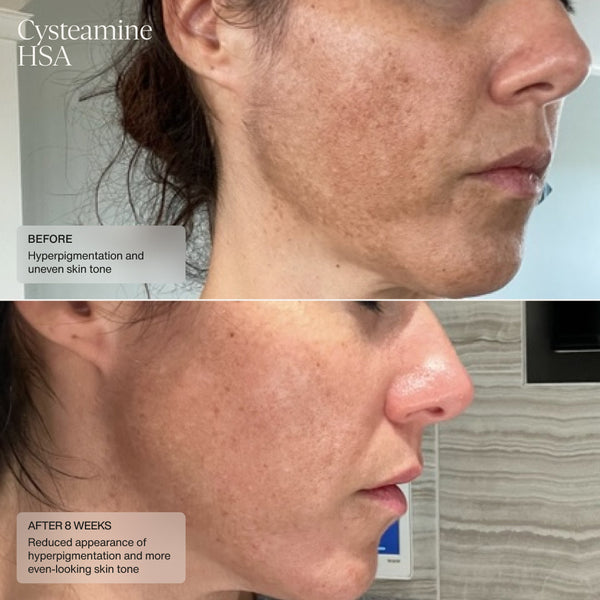 Senté Limited Edition Even Skin Tone Kit
