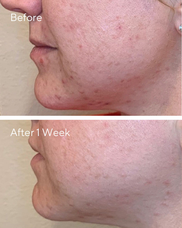 Murad Daily Clarifying Peel