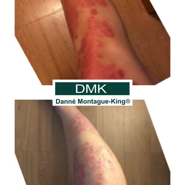 DMK Enbioment Mist