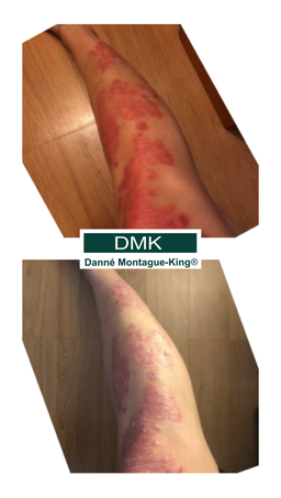 DMK Enbioment Mist