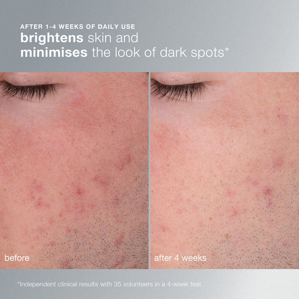 Dermalogica Daily Microfoliant®