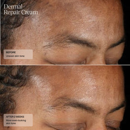 Senté Limited Edition Even Skin Tone Kit