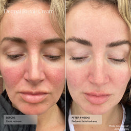 Senté Limited Edition Even Skin Tone Kit