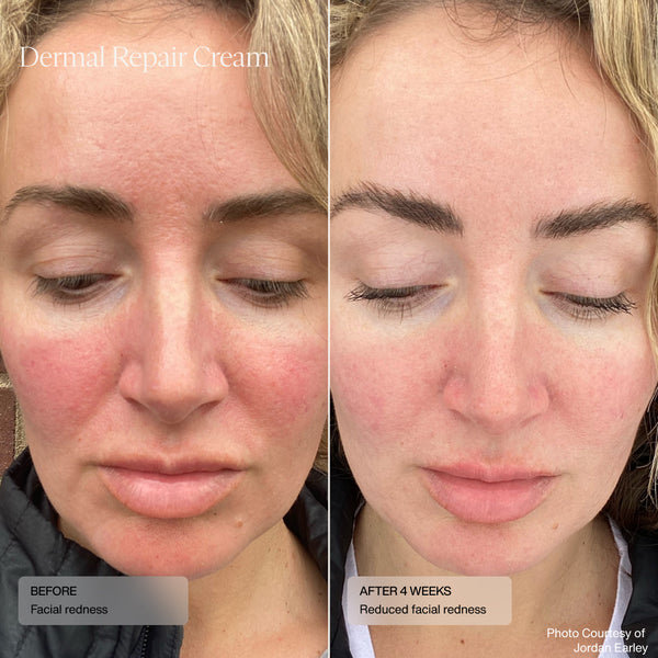 Senté Limited Edition Even Skin Tone Kit