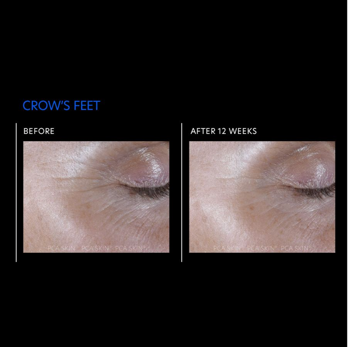before and after