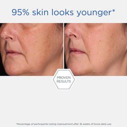 NeoStrata Rebound Sculpting Cream before and after