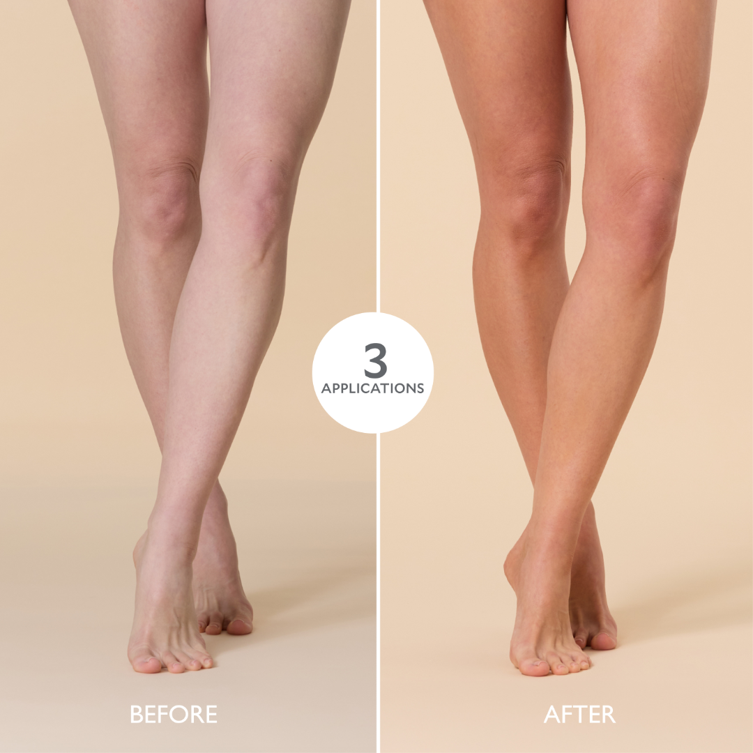 Before and after comparison of legs with three applications of a product on a beige background
