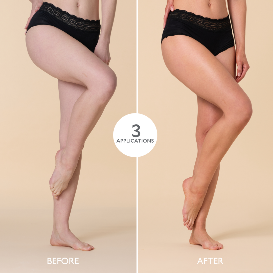 Before and after comparison of legs with a product application showing smooth skin.