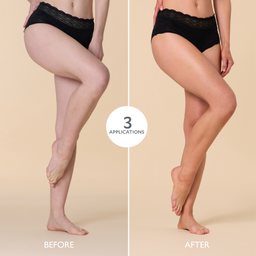 Before and after comparison of legs with a product application showing smooth skin.