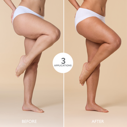 Before and after comparison of legs with a product application, on a beige background.