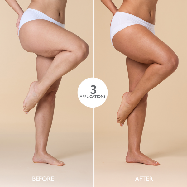 Before and after comparison of legs with a product application, on a beige background.