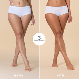 Before and after comparison of legs with three applications on a beige background