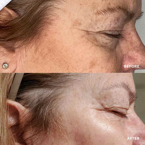 HydroPeptide Vital Eyes Instant Awakening Serum before and after
