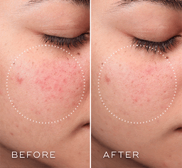 Medik8 Press & Clear