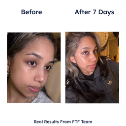 Germaine de Capuccini Expert Lab Tec-Exosome Intensive Hydro-Regenerating Treatment 7 x 2ml