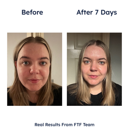 Germaine de Capuccini Expert Lab Tec-Exosome Intensive Hydro-Regenerating Treatment 7 x 2ml