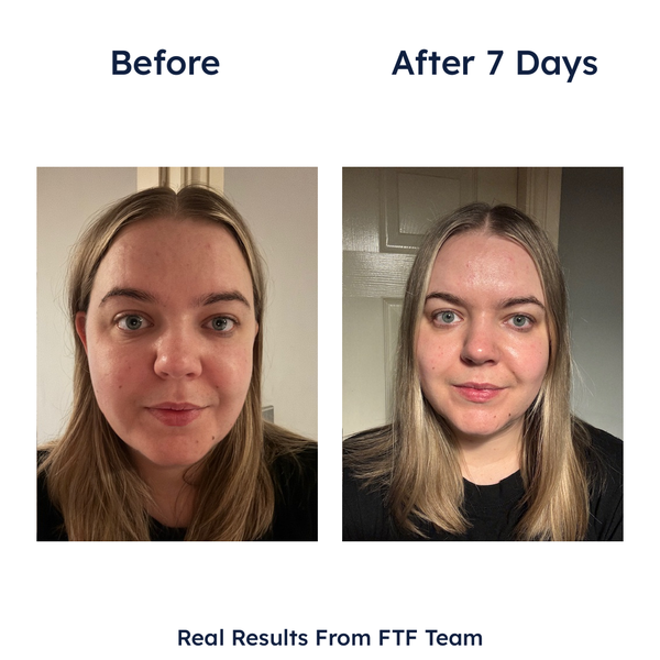 Germaine de Capuccini Expert Lab Tec-Exosome Intensive Hydro-Regenerating Treatment 7 x 2ml