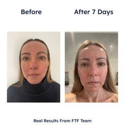 Germaine de Capuccini Expert Lab Tec-Exosome Intensive Hydro-Regenerating Treatment 7 x 2ml