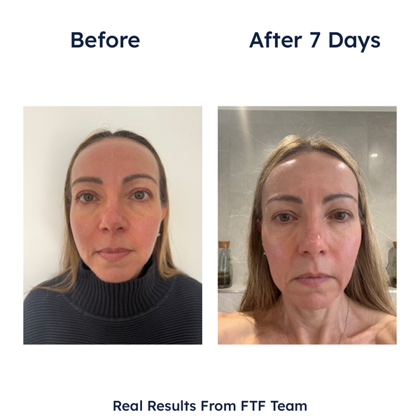 Germaine de Capuccini Expert Lab Tec-Exosome Intensive Hydro-Regenerating Treatment 7 x 2ml