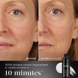 Before and after comparison of a woman's face with visible wrinkles, showing clinical improvement with Medik8 product.