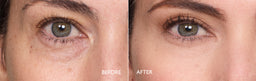Before and after comparison of a woman's eye with visible changes.