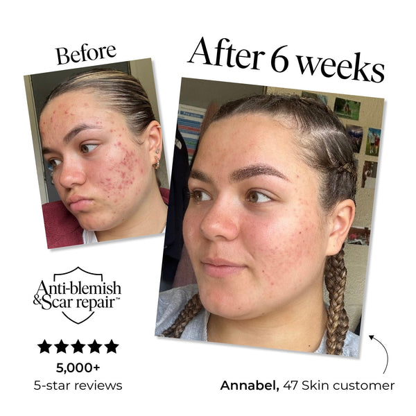 47 Skin Anti-Blemish and Scar Repair Serum 50ml