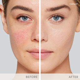 Before and after comparison of a woman's face with radiant skin on a gray background.