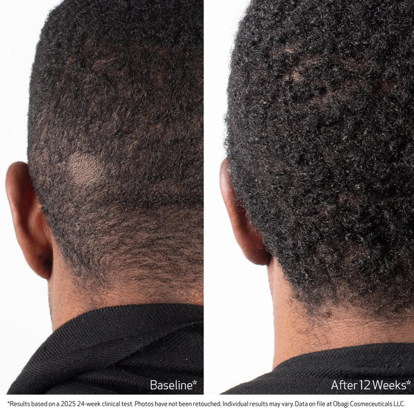 Obagi Nu-Cil Biostim Scalp Serum