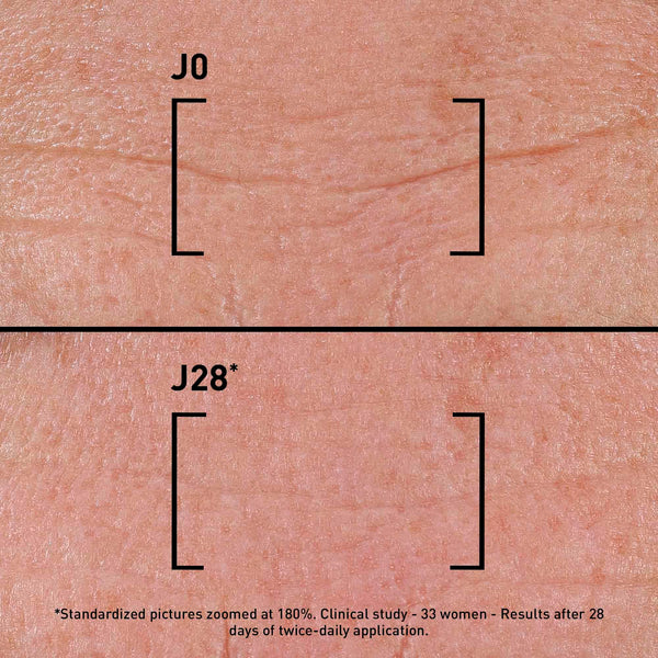 FILORGA TIME-FILLER INTENSIVE 5XP - Correcting Serum For All Types of Wrinkles