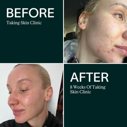 ARTAH Skin Clinic 120 Capsules