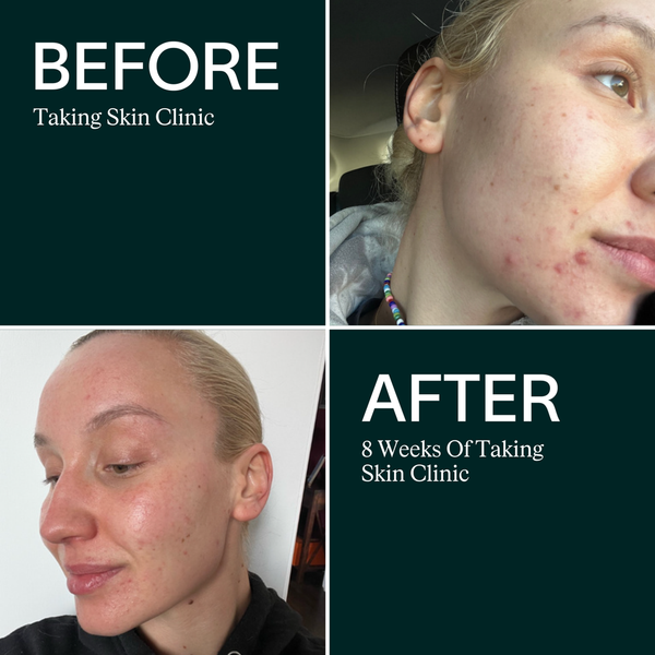 ARTAH Skin Clinic 120 Capsules