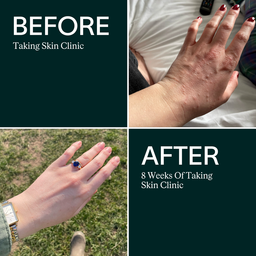 ARTAH Skin Clinic 120 Capsules
