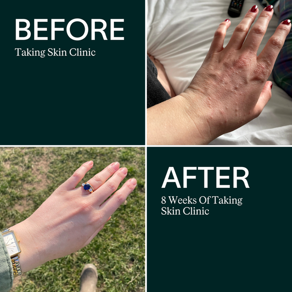 ARTAH Skin Clinic 120 Capsules