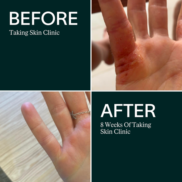 ARTAH Skin Clinic 120 Capsules
