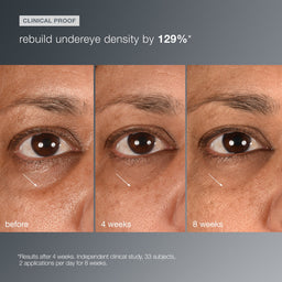 Dermalogica Smart Eye Density Serum 15ml