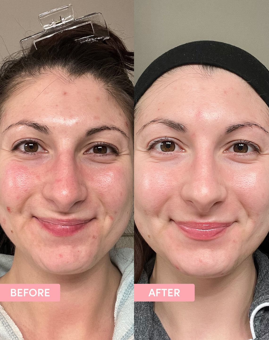 Before and after effect 