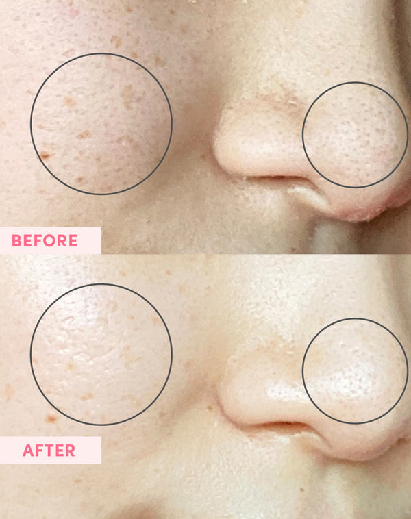 Before and after using the product showing a cleaner pores