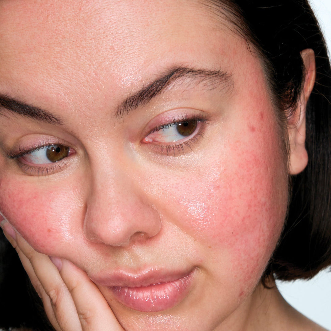Close-up of a woman's face with visible skin concerns