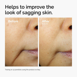 Before and after comparison of sagging skin improvement with text indicating product effectiveness.