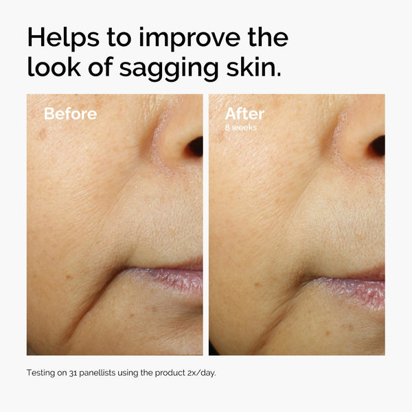 Before and after comparison of sagging skin improvement with text indicating product effectiveness.