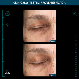 Allies of Skin 7 Days to Firmer Skin Anti Aging Skincare Kit