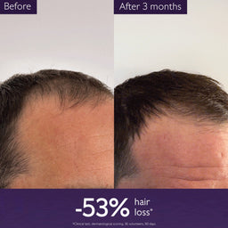 Caudalie Anti-Hair Loss Serum 50ml