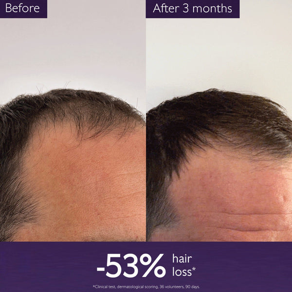 Caudalie Anti-Hair Loss Serum 50ml