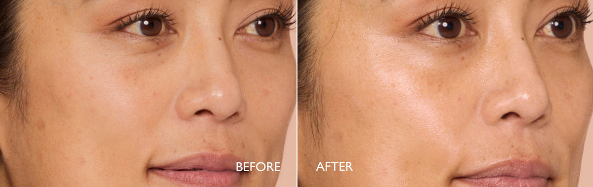 Before and after comparison of a woman's face with 'Before' and 'After' labels.