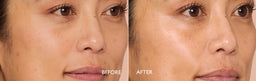 Before and after comparison of a woman's face with 'Before' and 'After' labels.