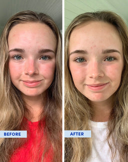 Before and after using the product