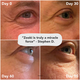 A four-panel before-and-after comparison grid showing a close-up of a person's eye and surrounding skin at Day 0, Day 30, Day 60, and Day 90, with a speech bubble quote in the center reading, "Zooki is truly a miracle force" - Stephen D.